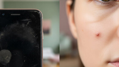 A smartphone with a dirty screen rests against a woman's cheek during a phone call, representing 'Habit #3: Never Cleaning Your Phone Screen.' This image illustrates a 'daily habit secretly damaging your skin' and contributing to 'adult acne