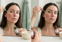 A split-screen comparison photograph showing a woman with visible facial redness applying CBD Facial Oil on the left panel and Tea Tree Oil on the right panel to test their effectiveness against inflammation.
