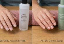 A close-up photorealistic shot of a woman concernedly examining her peeling fingernails next to a bottle of acetone-free nail polish remover