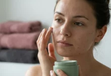 A gorgeous woman applying a soothing cream to treat adult acne while protecting her skin barrier