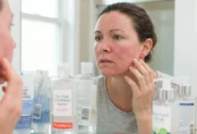 A woman with red, irritated adult acne checking her skin in a bathroom mirror, surrounded by harsh facial cleansers like "Oil-Free Stripping Wash," illustrating the effects of over-cleansing